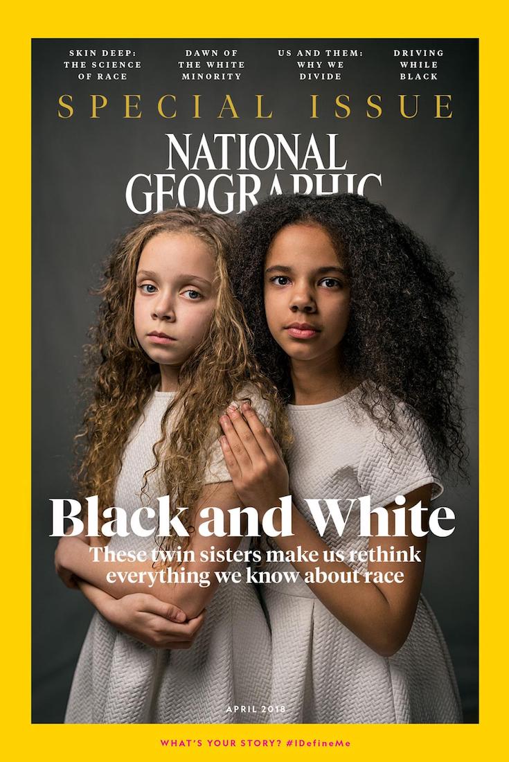 These Twins, One Black and One White, Will Make You Rethink Race | National Geographic